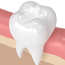 Dental Procedures Mill Creek