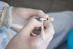 Dental Crowns in Mill Creek