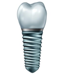 Single Tooth Implant in Mill Creek